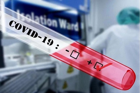 В г. Каменское за прошедшие сутки выявили 59 случаев коронавируса Днепродзержинск